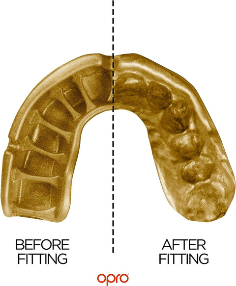 Power-Fit Mouthguard, Adults and Junior Sports Mouth Guard with Case for Boxing, Basketball, Lacrosse, Football, MMA, Martial Arts, Hockey and All Contact Sports