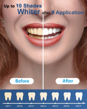 Teeth Whitening Kit with 5-LED Light, Non-Sensitive Mint Flavor 35%CP Teeth Whitening Gel, Tooth Whitener